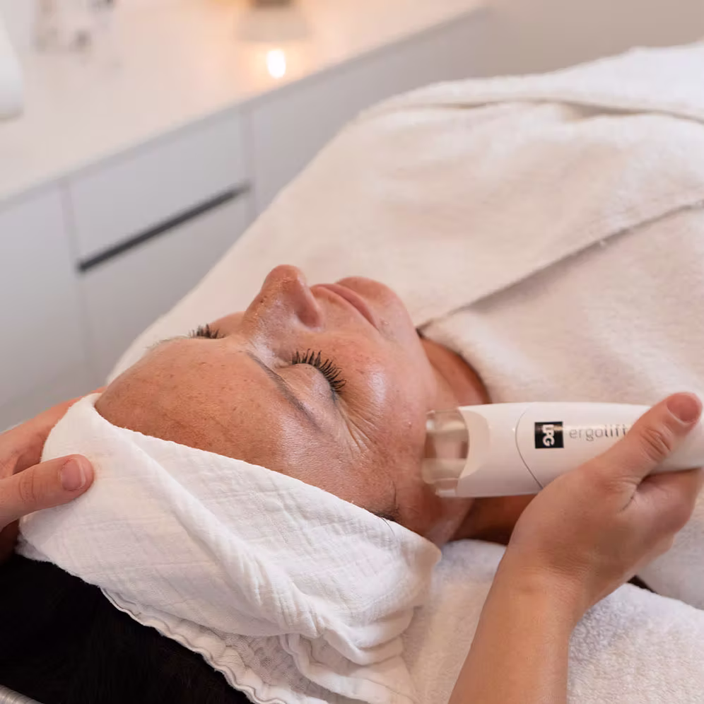 Microneedling